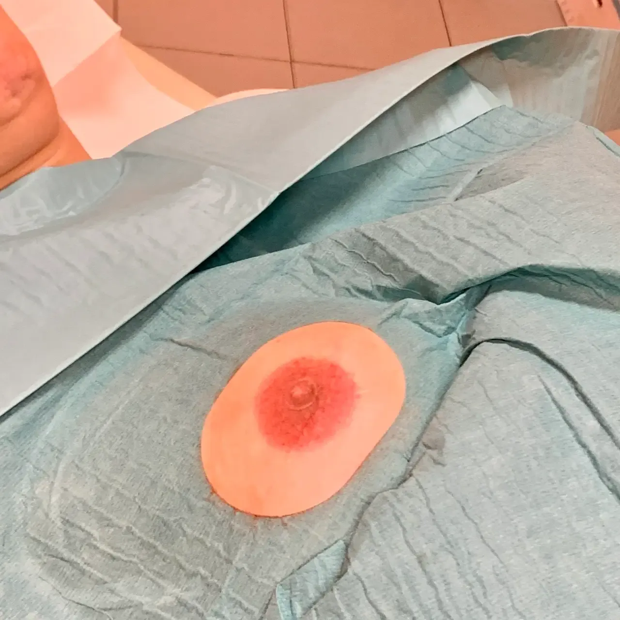 Foto del trattamento Dermopigmentazione Medicale