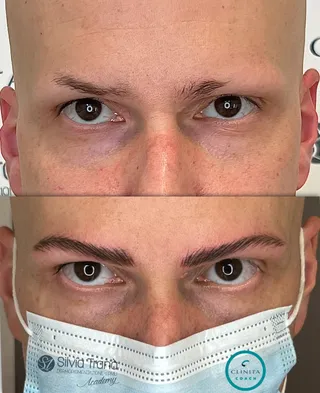 Alopecia — foto 5 di 5