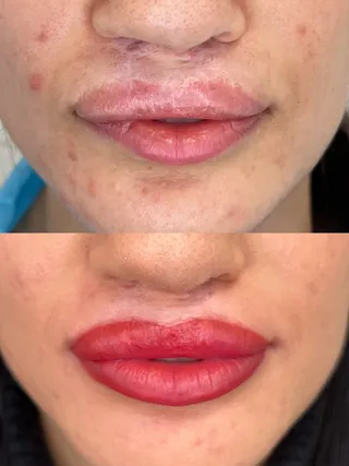 Labbra — foto 1 di 6